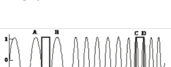 Gambar II.13. Sinyal yang frekuensinya berubah seiring dengan waktu (Sumber : Goswami dan Chan, 1999)