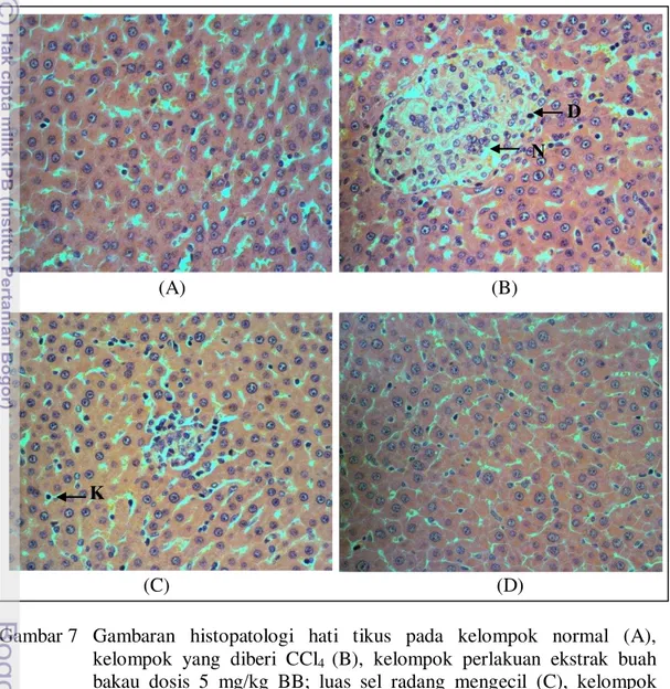 Gambar 7  Gambaran  histopatologi  hati  tikus  pada  kelompok  normal  (A),  kelompok  yang  diberi  CCl 4  (B),  kelompok  perlakuan  ekstrak  buah  bakau  dosis  5  mg/kg  BB;  luas  sel  radang  mengecil  (C),  kelompok  perlakuan  sylimarin  dosis  25