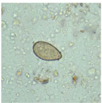 Gambar 2.4 Telur Clonorchis sinensis (Sumber : CDC, 2012) 