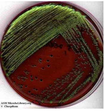 Gambar 2.3 Media EMBA Positif Escherichia coli 