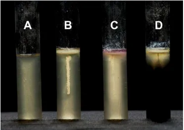 Gambar 2.4 Media SIM (Sulfur Indole Motility) Test 