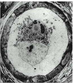 Gambar 6. Folikel primordial pada manusia (PF). Oosit dengan vesikel 