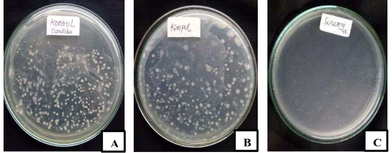 Gambar 1. Bentuk koloni dan warna koloni jamur yang dihasilkan pada (A) media PDA, (B) media umbi kimpul, (C) media umbi suweg  