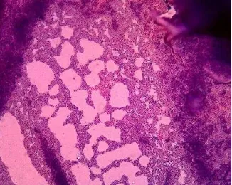 Gambar 2. Bentuk mikroskopis Staphylococcus aureus  