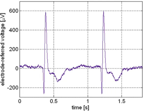 Figure 2.1: EMG signal 