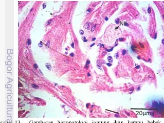 Gambaran histopatologi jantung ikan kerapu bebek terinfeksi Iridovirus. Nekrosa pada miokardium (NK)