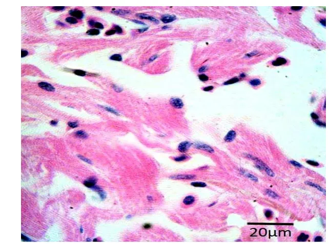 Gambar 14  Gambaran histopatologi otot jantung ikan kerapu bebek yang tidak 