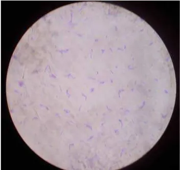 Gambar 4.  Lactobacillus plantarum  WCFS1          