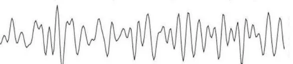 Figure 2.1: Alpha waves. [8] 