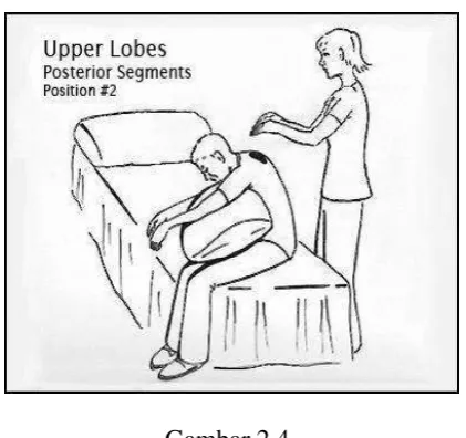 Gambar 2.4 Postural drainage upper lobus posterior segments 