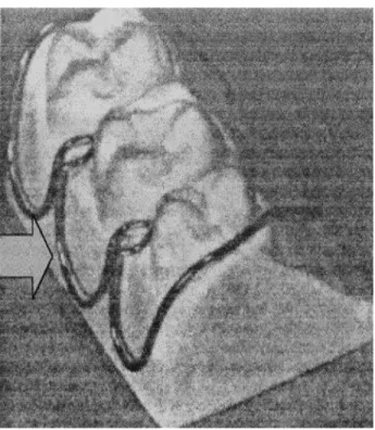 Gambar 6 : Klamer  kepala panah 