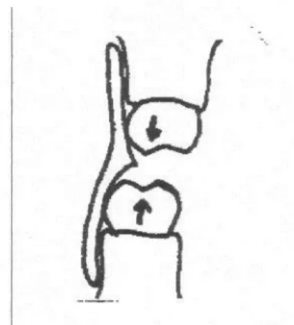 Gambar l : Bentuk pengasahan untuk ekstrusi molar 