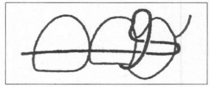 Gambar 19 : Busur labial dengan lup kombinasi vertikal dan horisontal  4.  Lup ganda (double Uloop) : Yaitu lup vertikal dengan dua belokan berbentuk huruf 