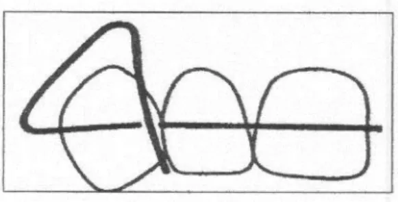 Gambar 22 : Posisi lengkung labial  Macam-macam busur labial : 