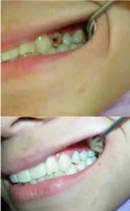 Gambar 5. Foto  sebelum (atas)  dan  setelah (bawah) perawatan