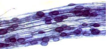 Gambar 7.3. Struktur somatik cendawan berupa sel tunggal (a), hifa 