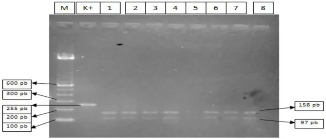 Gambar 1 Elektroforegram hasil RFLP gen CYP2D6*4 situs pengenalan BstNI. 