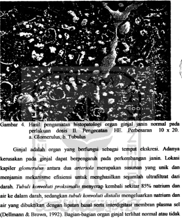 Gambar 4. Hasil pengamatan histopatologi organ ginjal janin normal pada perlakuan dosis II