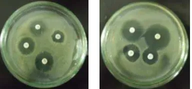 Gambar 2. Hasil uji sensitivitas pada bakteri (A)  