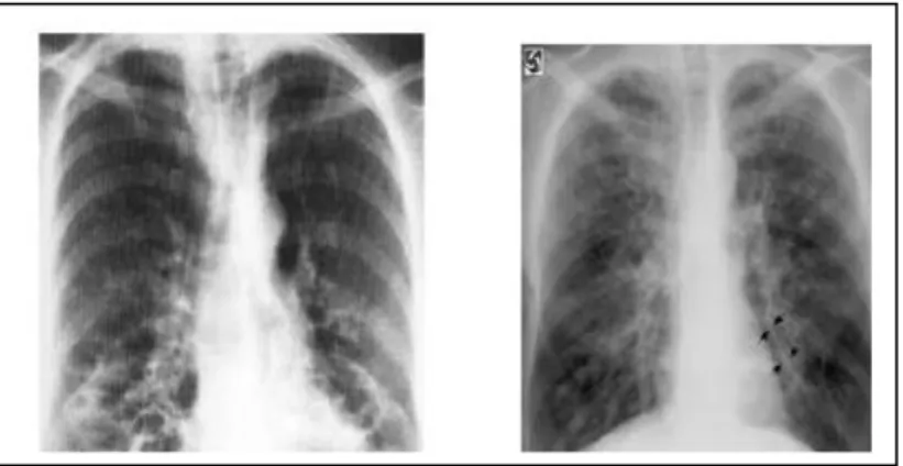 Gambar 3. Gambaran honeycomb appearance. 