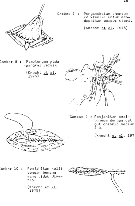 Gambar 7 Pengangkatan omentum 