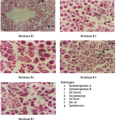 Gambar 5. Histopatologi Testis Mencit  