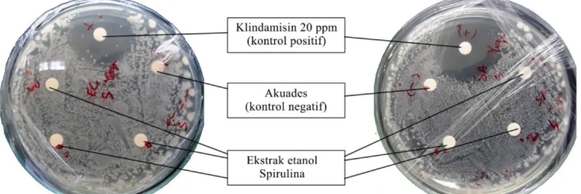Gambar 1  Analisis aktivitas antibakteri ekstrak etanol Spirulina platensis 