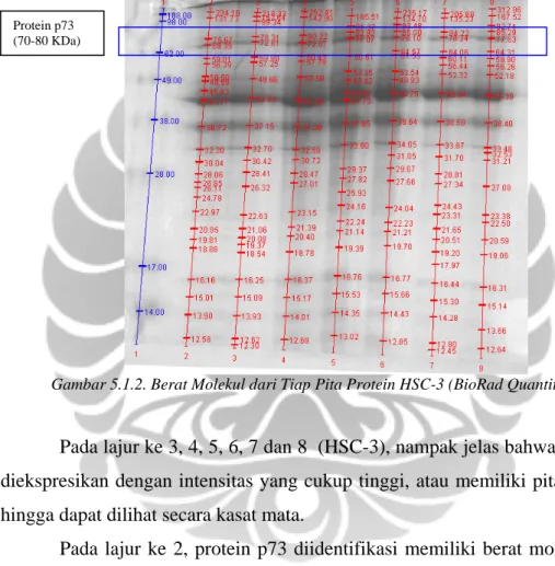 Gambar 5.1.2. Berat Molekul dari Tiap Pita Protein HSC-3 (BioRad Quantity One)  