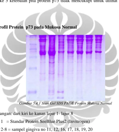 Gambar 5.4.1 Scan Gel SDS PAGE Protein Mukosa Normal 