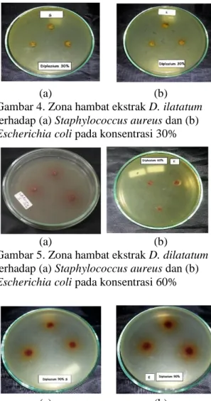 Tabel 2. Rataan diameter zona hambat ekstrak  Diplazium  dilatatum  terhadap  bakteri  Staphylococcus aureus dan Escherichia coli 