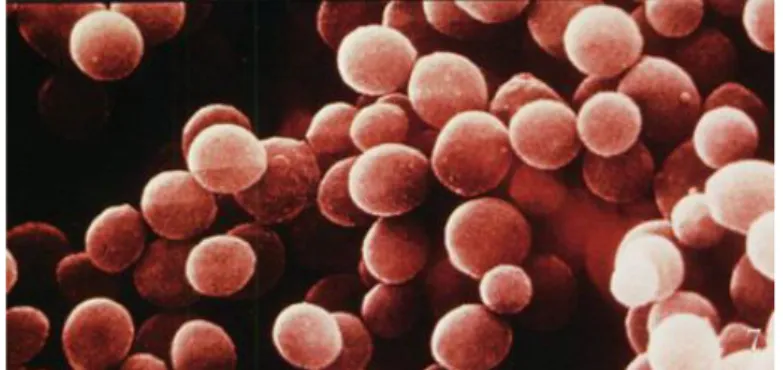 Gambar 3. Staphylococcus aureus yang Dilihat dari Mikroskop Elektron. 