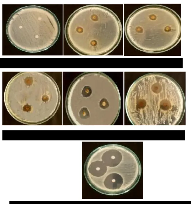 Gambar 1. Aktivitas antibakteri daun kecombrang terhadap bakteri Salmonella typhi