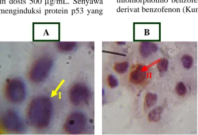 Gambar 3.  Foto mikroskopis hasil immunositokimia ekspresi protein p53 sel      EVSA-T,  inkubasi 48 jam (A)