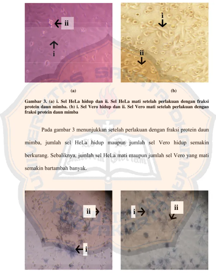 Gambar 3. (a) i. Sel HeLa hidup dan ii. Sel HeLa mati setelah perlakuan dengan fraksi  protein daun mimba