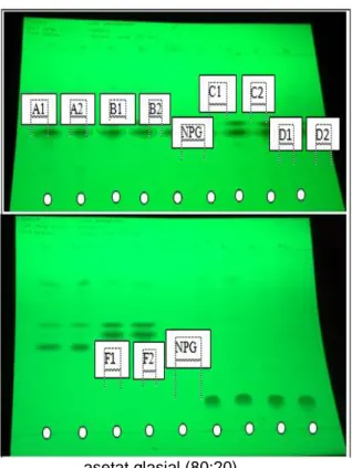 Gambar 1. Kromatogram  sampel  body  lotion  dengan  fase  gerak  toluen:asam 