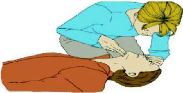 Gambar 7 :  Menutup  hidung korban sedang posisi kepala  tetap ekstensi ( Gobel 2009 ) 
