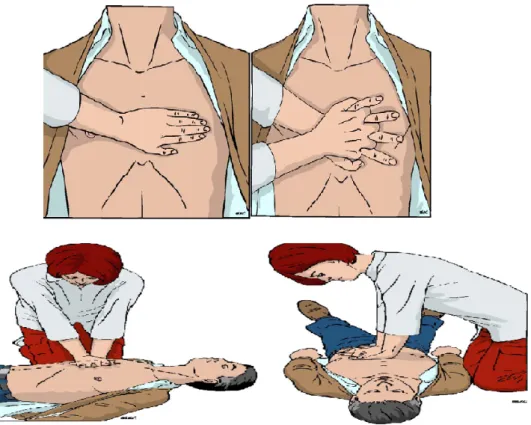 Gambar 2.6: Posisi Penolong Pijat Jantung (sumber: European Resuscitation Council Guidelines for  Resuscitation 2010).