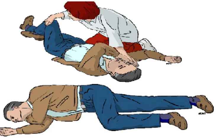 Gambar 2.7:  :  Recovery  Position (sumber: European Resuscitation Council Guidelines for Resuscitation  2010) 