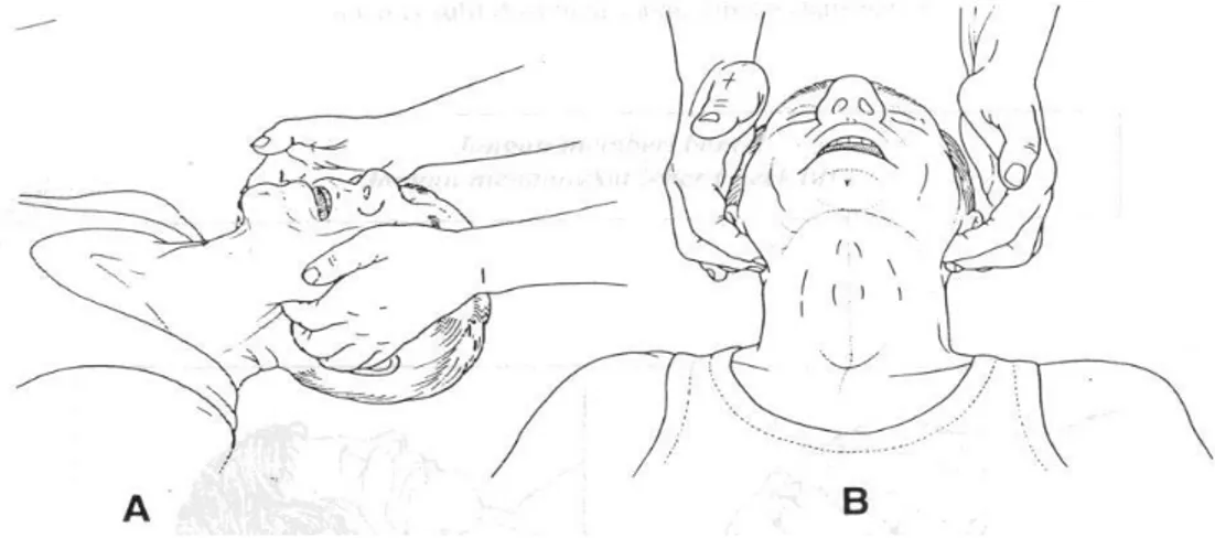 Gambar 6. Jaw Thrust