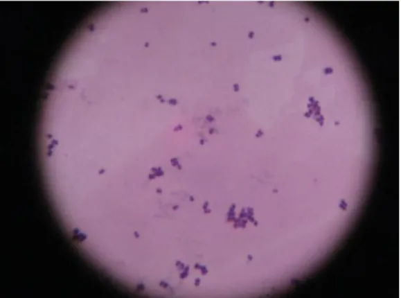 Gambar L-5.1: Hasil pemeriksaan mikroskopis dengan pewarnaan gram 