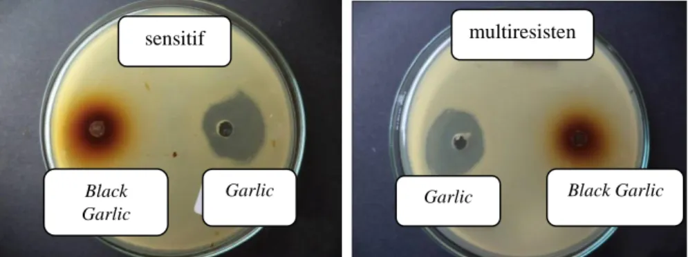 Gambar 1. Hasil uji bakteri ekstrak bawang putih (garlic) dan black garlic terhadap bakteri Escherichia coli 
