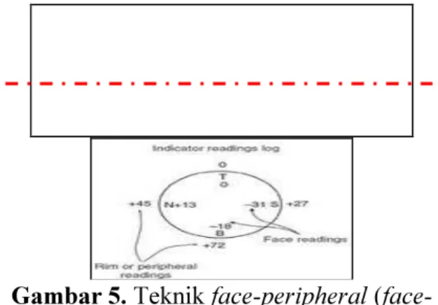 Gambar 5. Teknik face-peripheral (face- (face-rim) 