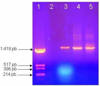Gambar 5.3. Analisis hasil PCR gen 16S rRNA. (1) Penanda pUC19/Hinf I, (2) Kontrol negatif, (3, 4 dan 5) 10 μL produk PCR sampel 1, 2 dan 3 dengan menggunakan pasangan primer BactF1 dan UniB1, ukuran diperkirakan sekitar 1,4 kb