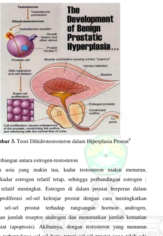 Gambar 3. Teori Dihidrotestosteron dalam Hiperplasia Prostat 8 