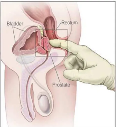 Foto  polos  perut  berguna  untuk  mencari  adanya  batu  opak  di  saluran  kemih,  batu/kalkulosa  prostat  atau  menunjukkan  bayangan  buli-buli  yang  penuh  terisi  urin,  yang merupakan tanda retensi urin