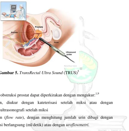 Gambar 5. TransRectal Ultra Sound (TRUS) 5 