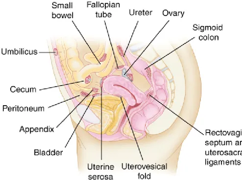 Gambar 3. Lokasi umum endometriosis. 1 