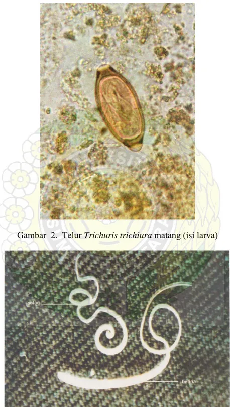 Gambar  2.  Telur Trichuris trichiura matang (isi larva) 