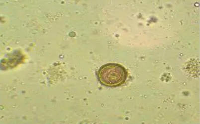 Gambar 2.3 Cacing tambang (Sumber: Sumanto, 2010)  2.2.3 Cara infeksi telur cacing ke tubuh manusia 