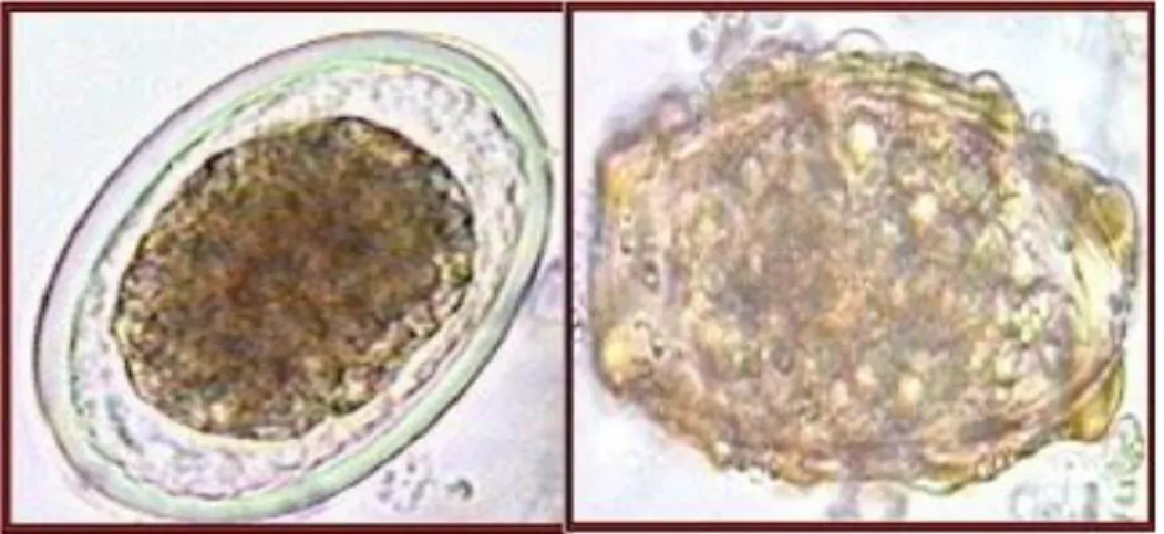 Gambar 2.2 Telur Ascariasis lumbricoides (Sumber: Lamara, 2013) 